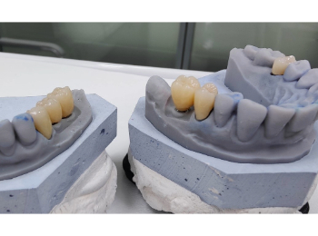 Fallbericht Zahnmodell