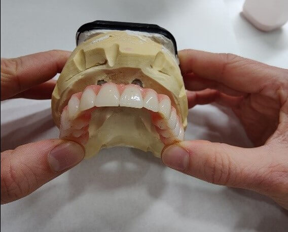 Genau mein Fall Gebiss Laborarbeit