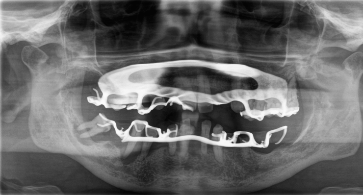Röntgenbild Erstbefund 